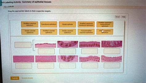 Art-labeling Activity: Summary Of Epithelial Tissues