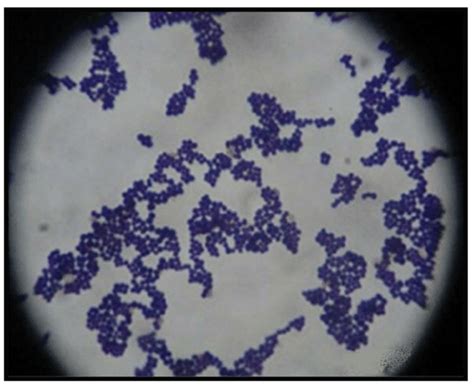 Choose Correct Interpretation For Staphylococcus Aureus Result