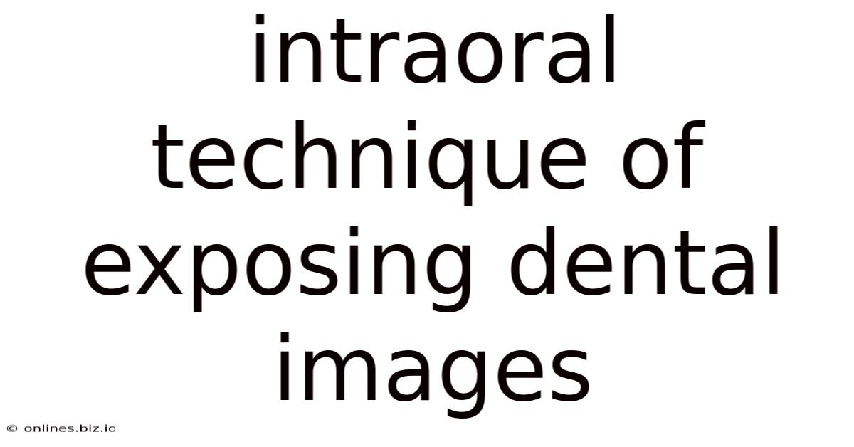 Intraoral Technique Of Exposing Dental Images