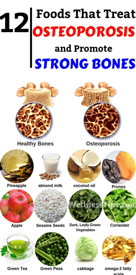 It's Recommended That Those With Osteoporosis __________.