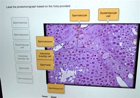 Label The Photomicrograph Based On The Hints Provided