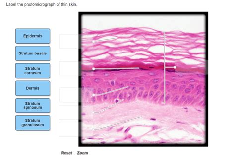 Label The Photomicrograph Of Thin Skin