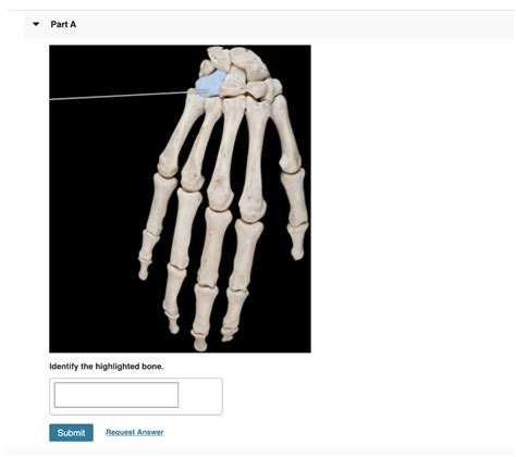 Pal Cadaver Appendicular Skeleton Joints Lab Practical Question 10