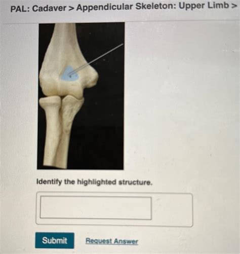 Pal Cadaver Appendicular Skeleton Upper Limb Lab Practical Question 3