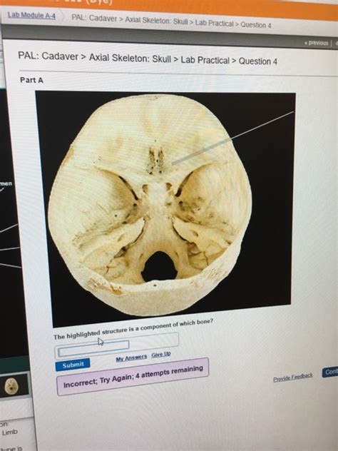 Pal Cadaver Axial Skeleton Skull Lab Practical Question 4