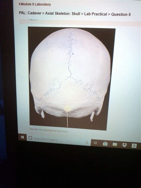 Pal Cadaver Axial Skeleton Vertebral Column Lab Practical Question 9