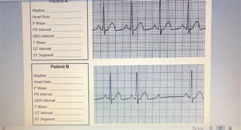 Part B Practice Interpreting Electrocardiograms Answer Key