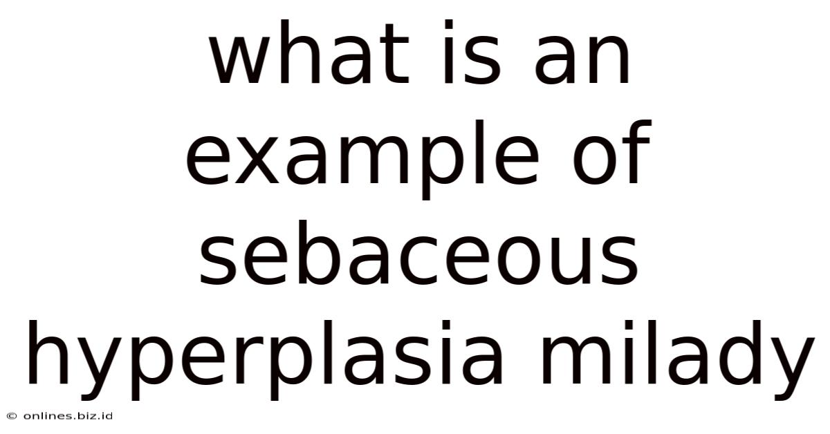 What Is An Example Of Sebaceous Hyperplasia Milady